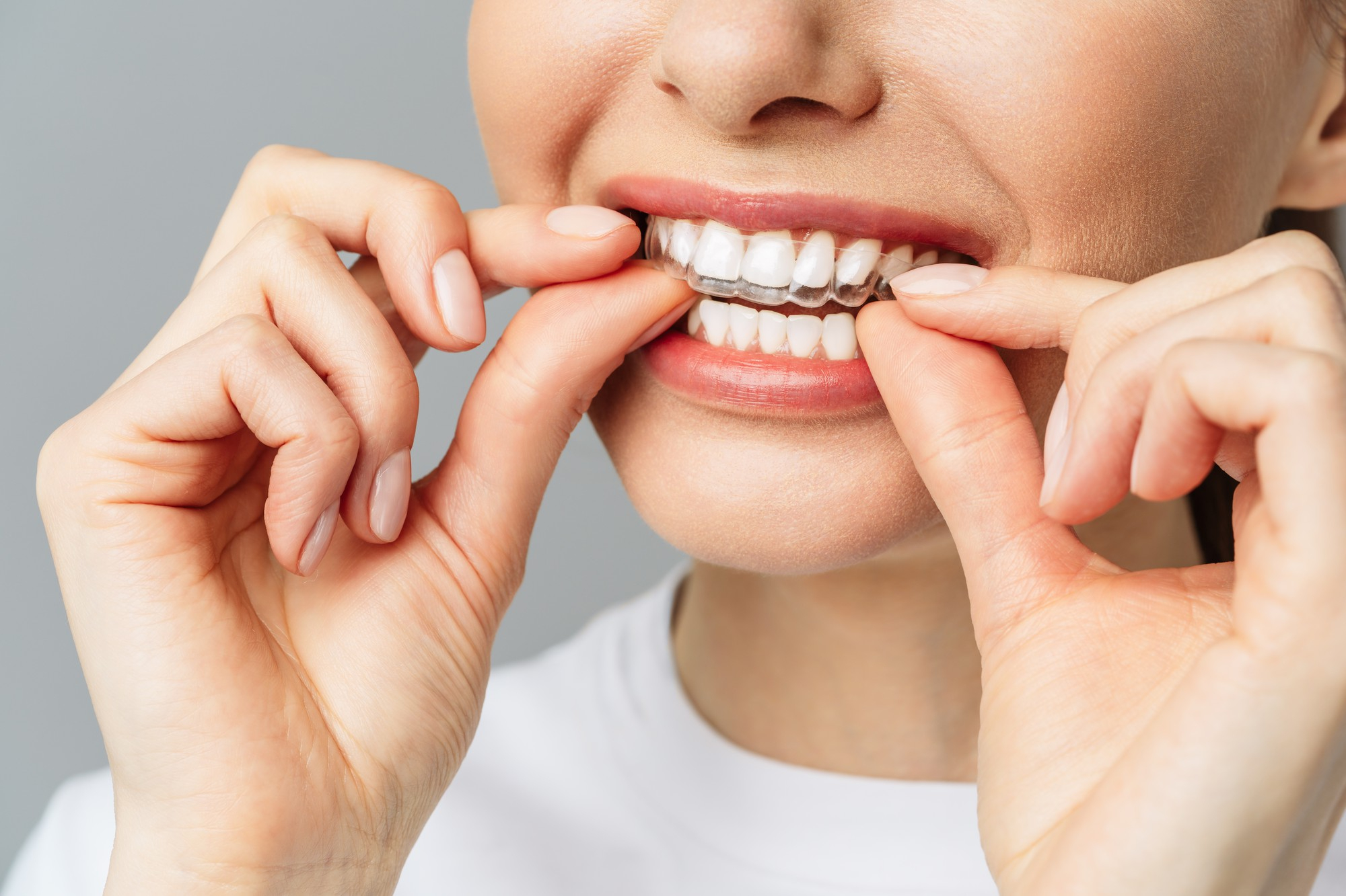 Orthodontic Services